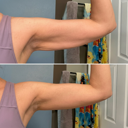 Mangas Armplify -  Para Brazos Más Firmes